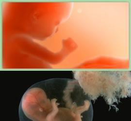 feto-10-semanas.jpg
